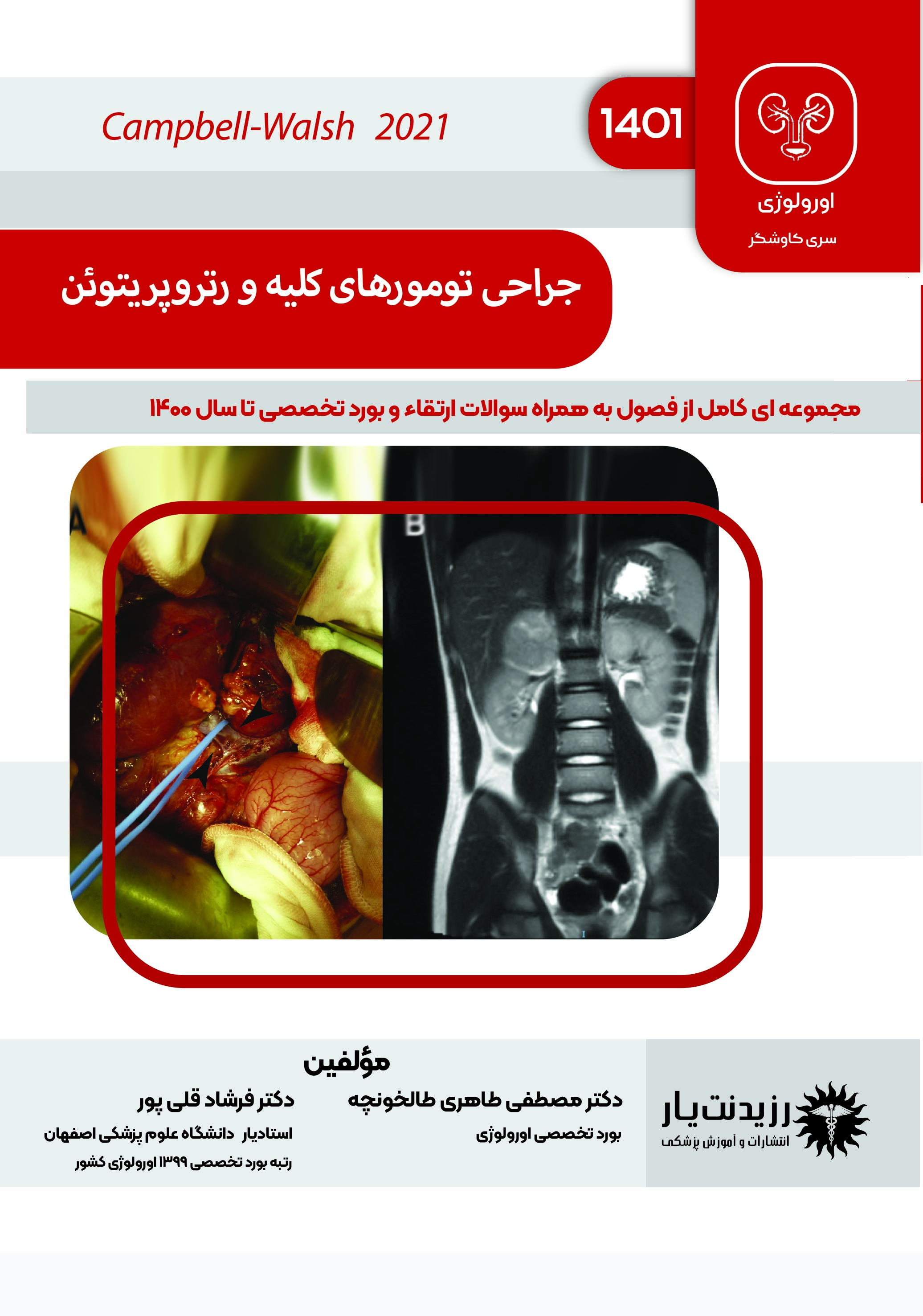 جلد 16 :جراحی تومرهای کلیه و رتروپریتوئن