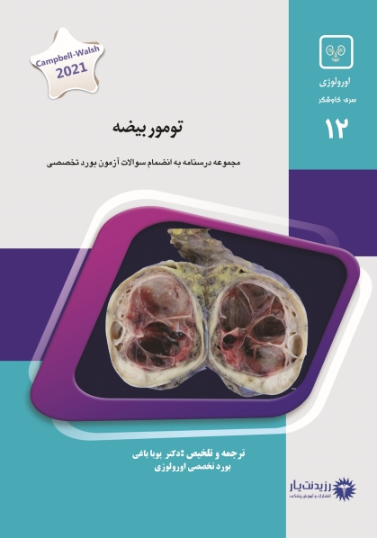 جلد 12 اورولوژی : تومور بیضه (آبی)