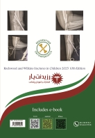 مشخصات، قیمت و خرید جلد 7 ارتوپدی : مرجع شکستگی‌های اندام فوقانی کودکان 1