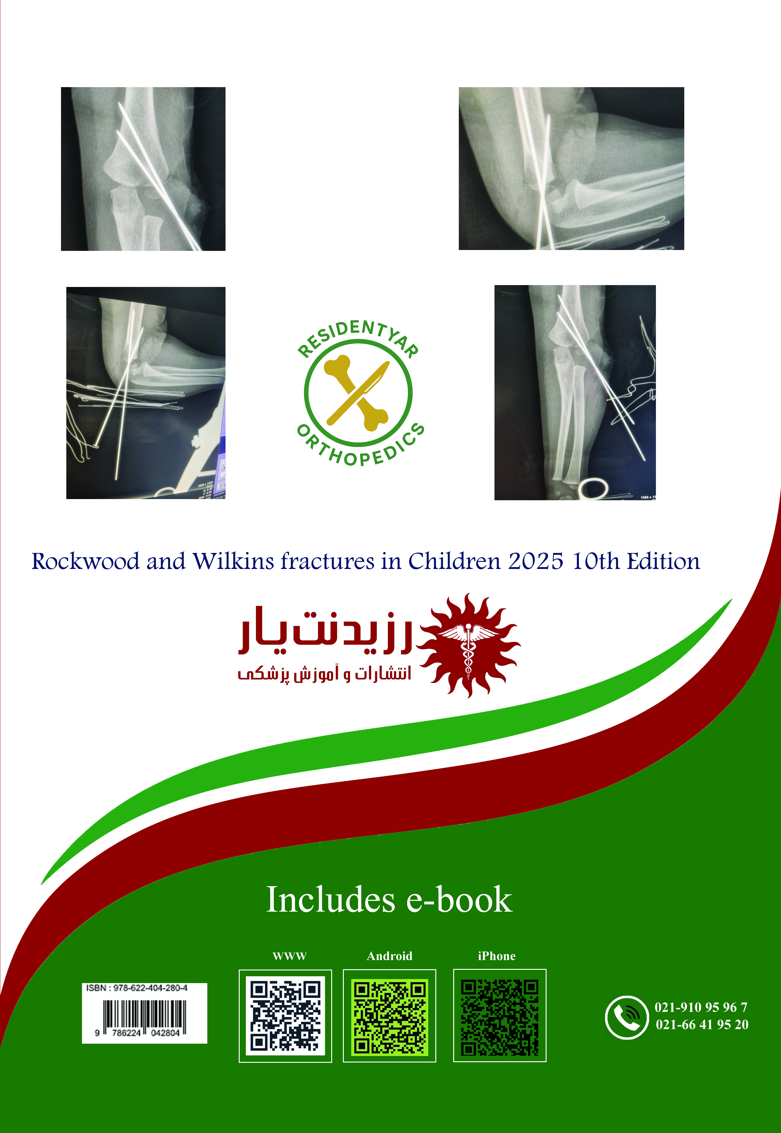 جلد 7 ارتوپدی : مرجع شکستگی‌های اندام فوقانی کودکان 1 - پشت جلد